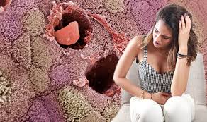 Feeling like you have to go, even after bowel. Bowel Cancer Symptoms The Three Main Signs Of Bowel Cancer You Must Be Aware Of Express Co Uk