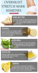 The Best Way To Remove And Get Rid Of Stretch Marks Naturally On Arms Thighs And Stomach Is To Moisturize So Stretch Mark Remedies Stretch Marks Skin Remedies