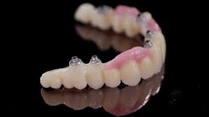 K Dental Lab Zirkonzahn Prettau Implant Screw Retained Bridge 1 Mov Dental Dental Lab Dental Implants