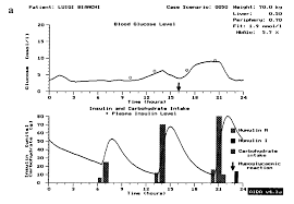 carb insulin literature bg web time physician graph