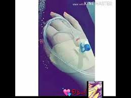 صور ايدين بنات مريضات youtube