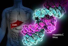 Around 2.4 million people in the united states are. 19 Hepatitis C Symptoms And Transmission Treatment Information