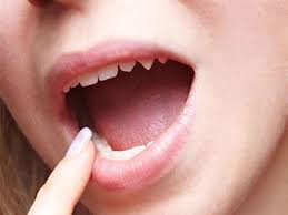 عرض ا لبعض الأمراض 9 أسباب وراء تغير لون اللسان إلى البنفس الكونسلتو