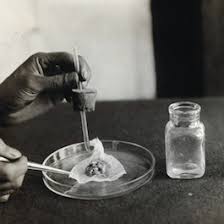 These include vaccines for polio, rabies, chicken pox, hepatitis b and measles. Early Tissue And Cell Culture In Vaccine Development History Of Vaccines
