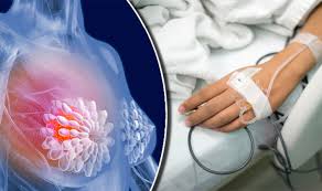There was no pain & she felt ok one morning she woke up with sore arm and unable to lift it up. Breast Cancer Signs Third Of Those Diagnosed Have Symptoms Other Than Lump Express Co Uk