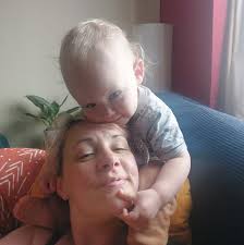 Alternative to UV resin for hives prevention?