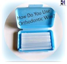 While they do a great job at getting your misaligned teeth straight again, they can in this article, we will talk about how to make your braces stop hurting. Will Braces Hurt How Do You Use Orthodontic Wax L M Orthodontics Orthodontists In Doylestown Glenside Perkasie Pa Warrington Bucks County Montgomery County