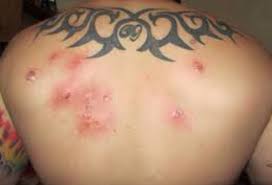 01:47 2,98 мб 212 кб/с. Botfly By Gloria Tavares