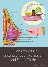 Pin On Healthy Breasts