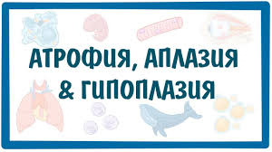 The reason of aplasia development on author's opinion was not inherited factor. Atrofiya Aplaziya I Gipoplaziya Youtube