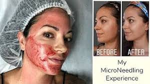 Pin On Beauty Ful Makeup Skincare Hair And Nails