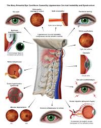 Image result for Eye Pain