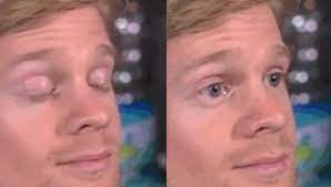 White Guy Blinking Sticker By Cheesy Puffs Blinking Guy Meme Create Memes Meme Template