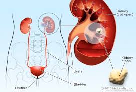 A good amount of area is covered by the abdominal wall. Abdomen Picture Image On Medicinenet Com