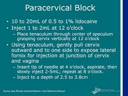 Image result for Paracervical Block