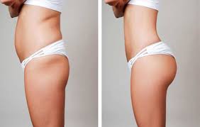 How long does a brand new vacuum cleaner last? Bbl And Body Contouring Neo Derm