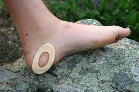 How To Prevent & Treat Blisters - Adventure Equipped
