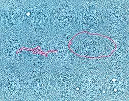 Cells are destroyed, cold sore develops burton's microbiology: Lambda Phage Dna Photograph By Dennis Kunkel Microscopy Science Photo Library