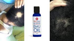 This essential hair growth oil is made of 17 other hair oils, but the three main ingredients are tea tree oil, horsetail powder, and emu oil. Emu Oil For Hair Growth Youtube