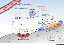 Of course, your specialist is the main person whose advice you should follow but it doesn't do anyone harm. Emerging Players In Prostate Cancer Bone Niche Communication Trends In Cancer