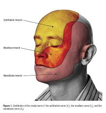 In Depth Article Discusses The Etiology And Differential Diagnosis Of Trigeminal Neuralgia Trigeminal Neuralgia Neuralgia Facial Neuralgia