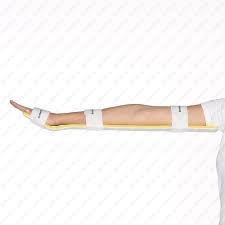 Image result for Long Arm Splint