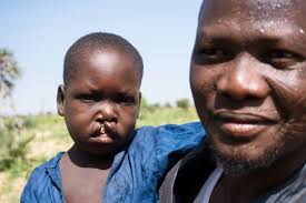 Spenden&Legate — Cleft-Kinder-Hilfe Schweiz