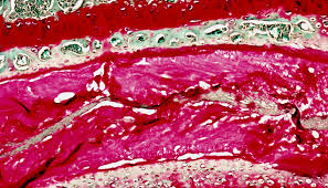Periodontics & Oral Medicine