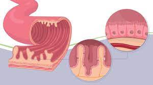 Überprüfen sie die übersetzungen von 'flatulenz' ins bulgarisch. Darmbeschwerden Symptome Ursachen Und Behandlung