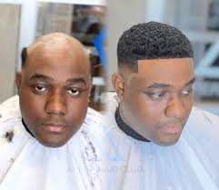 Dapper Hair Club is in Raleigh, NC.