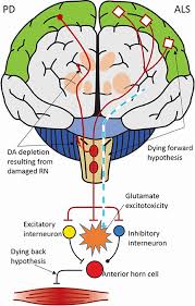 E is based upon complex interactions of genetic predispositions, environmental triggers, and immune dysregulation. Frontiers Serotonergic Dysfunction In Amyotrophic Lateral Sclerosis And Parkinson S Disease Similar Mechanisms Dissimilar Outcomes Neuroscience