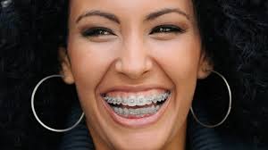 Kjeveortoped, Kjeveortopedi Asker