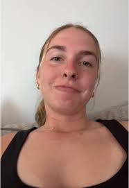 I’m a little burnt 😍