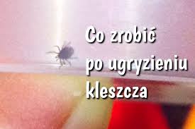 Borelioza jest w polsce najczęstszą chorobą przenoszą przez kleszcze. Co Zrobic Po Ukaszeniu Kleszcza Domowa Tv