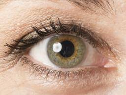 Central Heterochromia Two Different Eye Colors Causes And