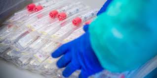 Präparieren sie die einzelteile wie in der beigelegten anleitung beschrieben, husten. Eth Makes Laboratory Equipment Available For Coronavirus Tests Eth Zurich