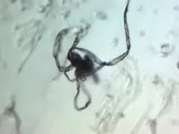 Image result for Pinworm Test