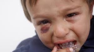 Wir waren im urlaub und aufgrund der neuen umgebungssituation ist mir mein zu dem zeitpunkt 8 monate altes baby aus dem bett gefallen. Unfalle Bei Kindern Ein Sturz Auf Den Kopf Kann Fur Kinder Bose Enden Welt