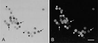 Image result for G6PD Deficiency Detection