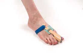 Hallux Valgus 10 Fakten Naturlich Behandeln Ursache Schmerzen