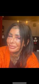 This is one of the more mild surgeries I've had, but had an upper and lower  blephroplasty 18 months ago and managed to get pics of what was removed 😍  Only took