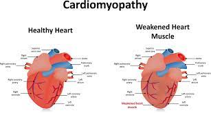 Enlarged Heart In Dogs Cardiomyopathy What You Must Know
