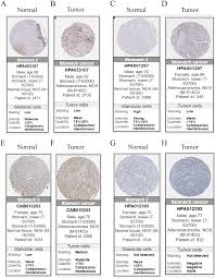 Normal tissue data expression profiles for proteins in human tissues based on the data is based on the human protein atlas version 20.1 and ensembl version 92.38. Https Peerj Com Articles 8504 Pdf