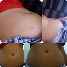 Coooonfusa Sera Que E Gravidez Babycenter