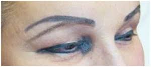 The tattoo makeup that will not rub off. Permanent Makeup Tattoo Removal Nyc Beauty World Nyc 718 883 0136 Beauty World Nyc
