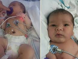 Fundraiser for Mallory Carter by Torry BOese : Help Sweet Beckham and his  Parents