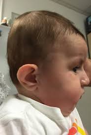 TESTAREA GENETICĂ ÎN BOLILE RARE