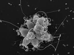 Image result for Microcoelia globulosa