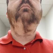 For even darker roots, opt for a tone that is more than two shades darker. Is This Normal I M 36 Last Year My Entire Beard Was Dark Brown Over The Last Few Months I Have Developed These Light Patches I Haven T Had Any Other Hair Color Changes