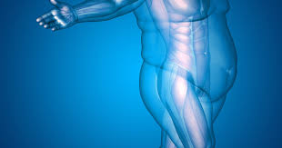 Image result for Obesity